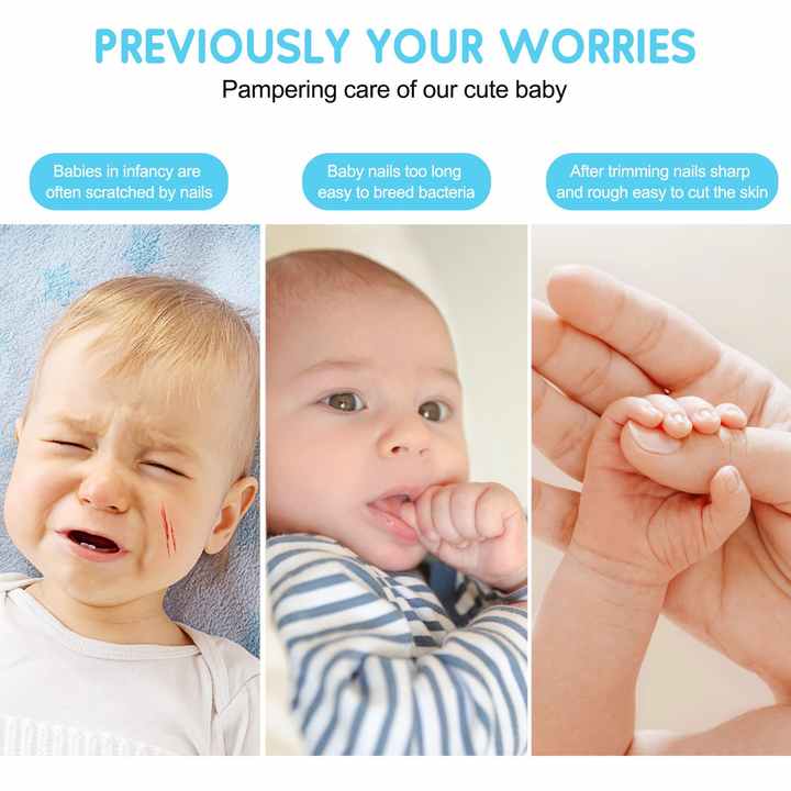 Rakshak Baby Nail Trimmer Safe Electric Baby Nail Cutter Pack of 1