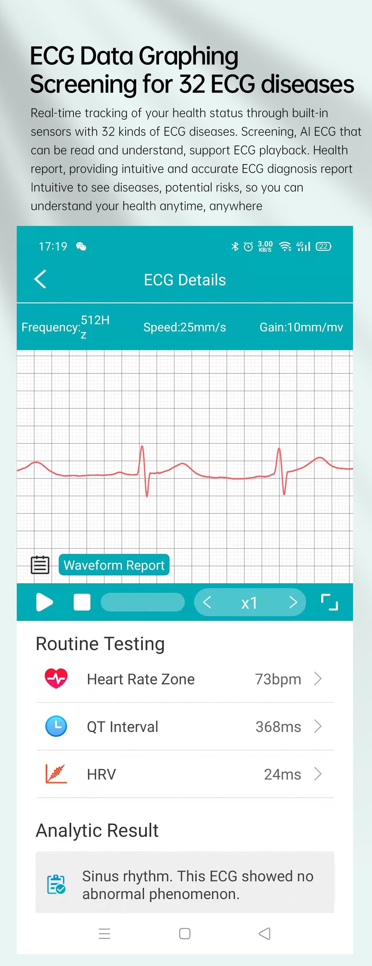 PROLUMI Wearable ECG Monitor